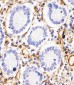 RHBDF2 Antibody (N-term)